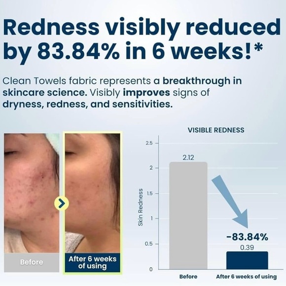 Disposable Face washing towels Large size 50 pack keep skin bacteria free - Picture 2 of 3